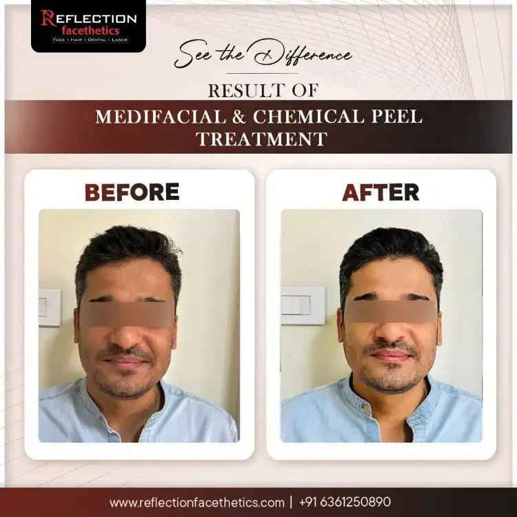 Medi Facial